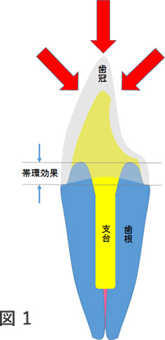 歯内療法後の補綴治療