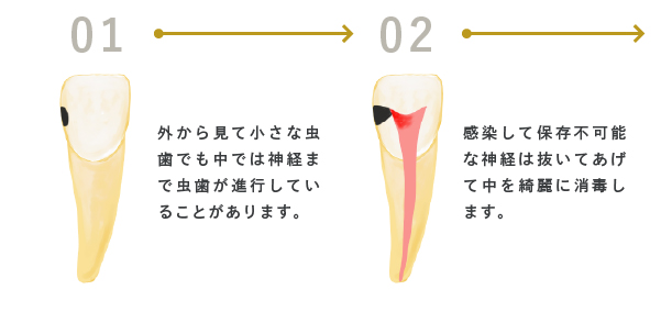 当院の治療のポイント