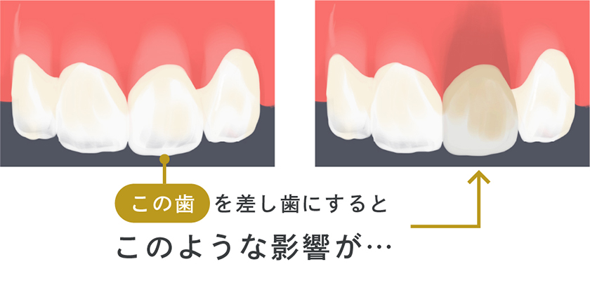 審美歯科のこれまでの施術