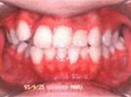 ortho_case5